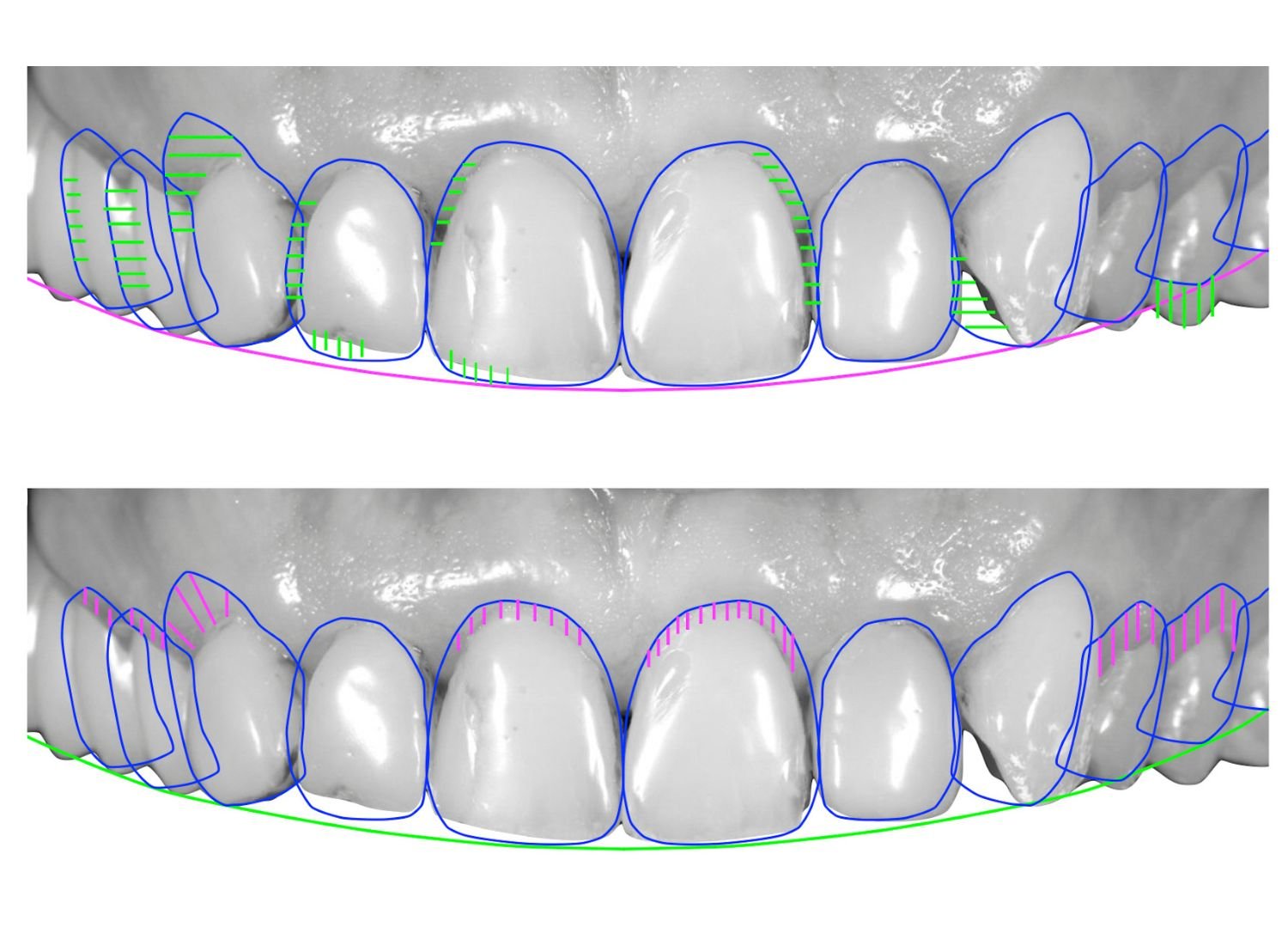 Smile Designing